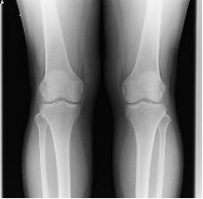 �G�̃����g�Q��